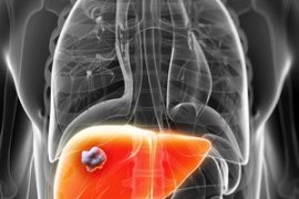 Is your Liver Behaving Badly? - Top 10 signs of sluggish liver function