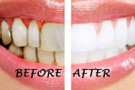 What the heck is oil pulling and would you try it?