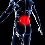 Top four therapeutic herbs for sciatic pain