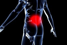 Top four therapeutic herbs for sciatic pain
