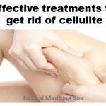 7 Effective treatments to get rid of cellulite