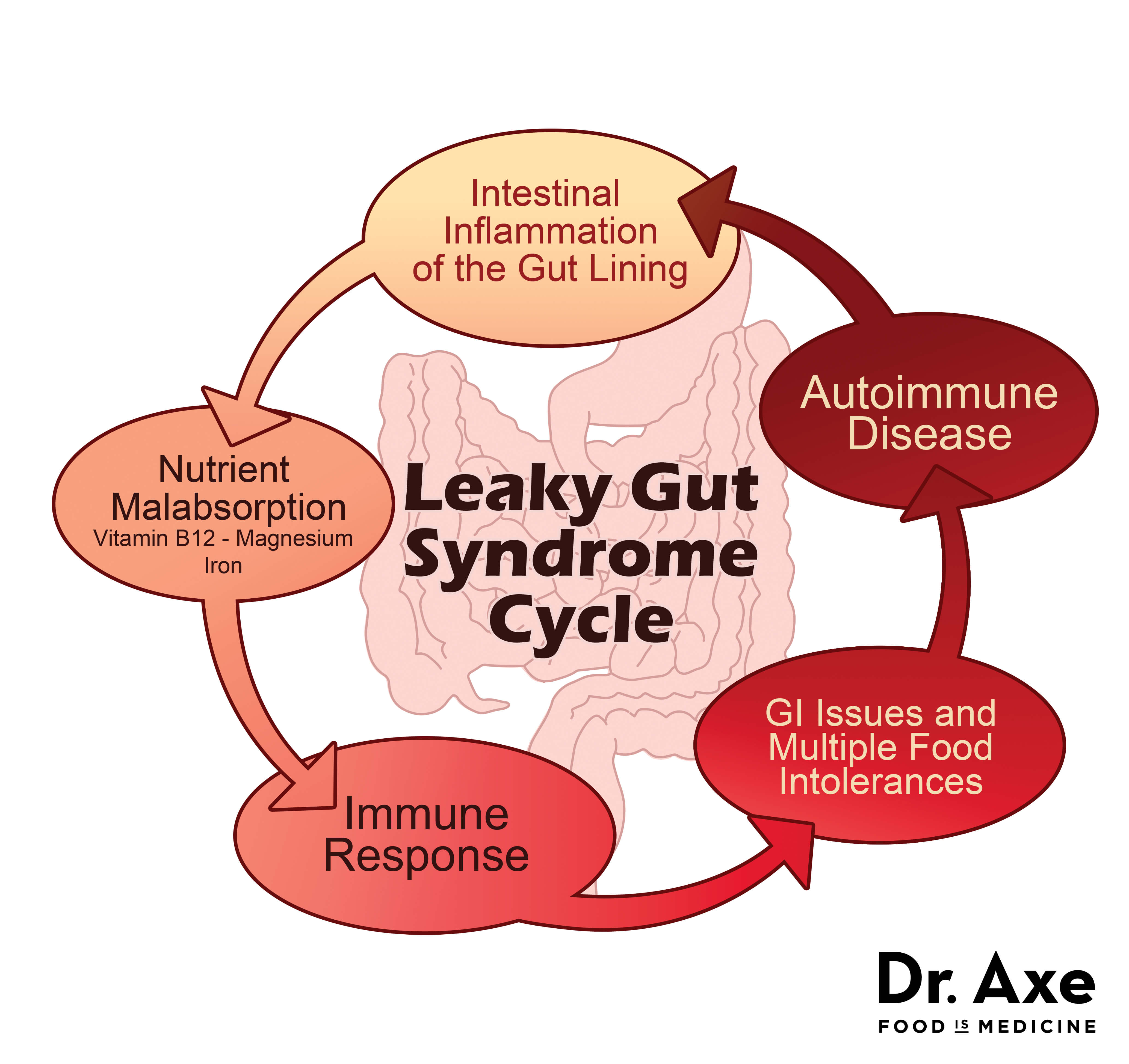 leaky gut chart