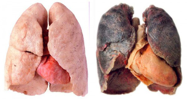 The Best Natural Way To Clear Your Lungs Of Nicotine and Tar