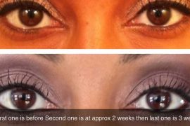 The Miraculous Hair Growth Oil for Eyelashes and Eyebrows