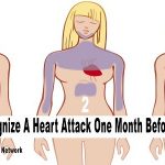 Heart Attack Warning System