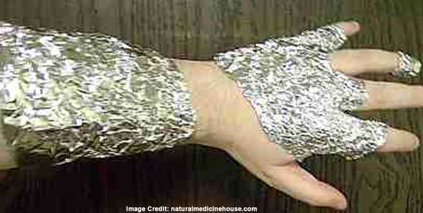 Aluminum Foil as an Anti-Inflammatory Agent