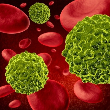 NEWS: Man Claims Cannabis Oil Cured His Bowel Cancer