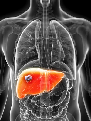 Is your Liver Behaving Badly? - Top 10 signs of sluggish liver function